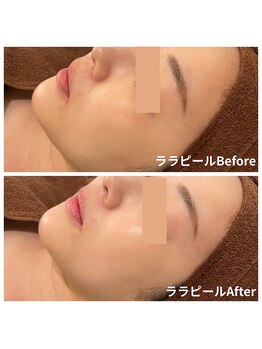 ビビ(VIVI)/ララピールで艶肌に