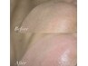 【FACE WAX】うぶ毛＋角質ケア全顔（単品）　60分