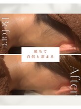 ビーエックス(.BX)/全身脱毛・うなじ脱毛・ワックス
