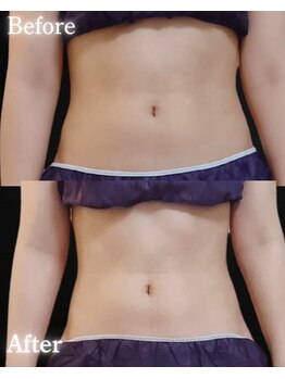 サンティエ(Santie)/お腹ケア