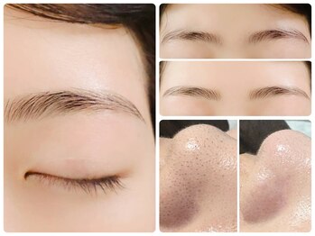 トータルビューティ ノイド(Noid)/いちご鼻撃退+美眉毛WAX脱毛