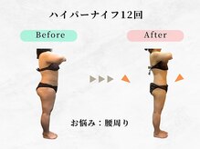 美容整体ウェリナ 名駅院/小顔矯正/骨盤矯正/痩身整体