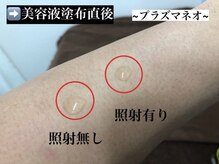 シャルムクリニカルサロン 池袋(Charme clinical salon)/美容液の浸透率実験◎プラズマ