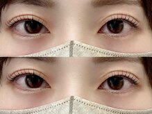 ミーアイラッシュ(ME.eyelash)/LASH LIFT