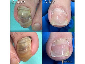 巻き爪補正店 町田店/