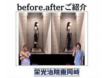 栄光治院 整体院東岡崎/猫背矯正