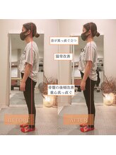 サンテリア(Santelia)/猫背と太ももの張り