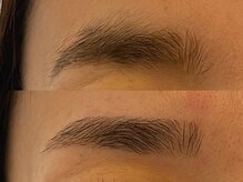 アンベリール(Embellir)/眉毛beforeafter