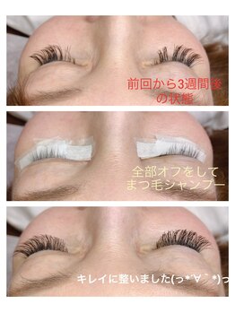 サロンドシャルム(Salon de charme)/特許技術メガマットボリューム