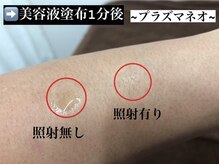 シャルムクリニカルサロン 池袋(Charme clinical salon)/美容液の浸透率実験◎プラズマ