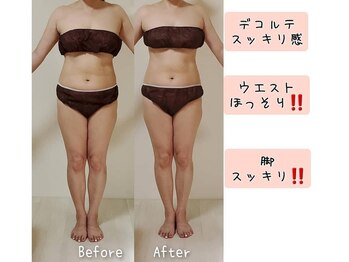 ラエッセス(A Laessess)/別人級美ライン痩身エステ