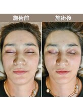 シェア 人形町店(Chare)/【小顔・骨盤矯正・О脚・整体】