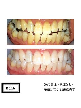 レオン 磐田(REON)/◇ お客様 before＆after ◇