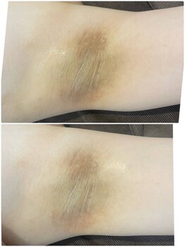 アネル 浦添店(anel)/