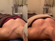 ジェイオー(J.O)/バストアップコルギ/小顔コルギ