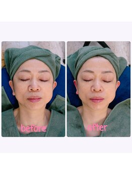 アコベル(Ako-Bell)/Face Slimming