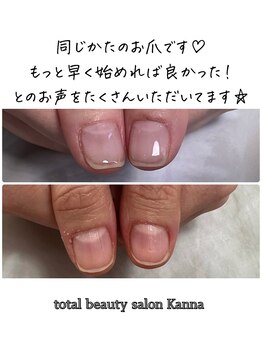 カンナ(Kanna)/5500円