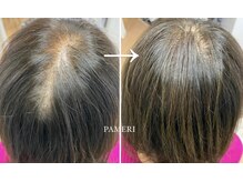 パメリ(PAMERI)の雰囲気（PAMERIの増毛技術は自然な見た目でボリュームUPヘアに◎）