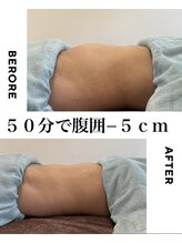 グレースヒーリング(GRACE HEALING)/