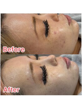 グランヴェルデ(GRAND VERDE)/素肌が覚醒する瞬間