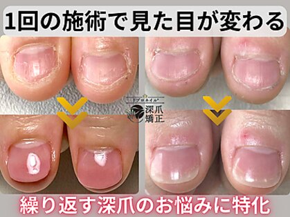 ポメロ(POMELO)の写真