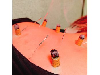 エイトはり・きゅう院