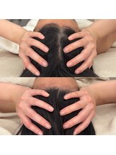 ケリービューティーサロン(kelly beauty salon)/頭の浮腫がなくなれば小さく！