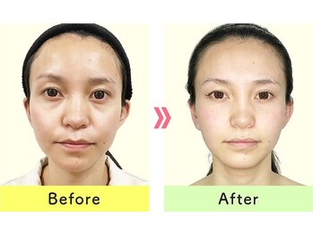 【小顔矯正・顔の歪み矯正・骨盤矯正・姿勢矯正】美容整体プラスフィール池袋店/美容整体/エステ/リラク/コルギ