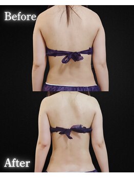 サンティエ(Santie)/背中美人