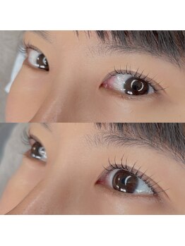 アルゲディ(Algedi)/パリジェンヌラッシュリフト