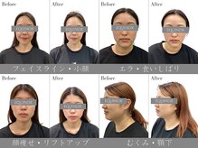イクイノックス 錦糸町(EQUINOX)
