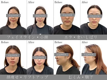 イクイノックス 錦糸町(EQUINOX)の写真