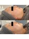 チェックミー(Check me)の写真/韓国美容の肌質改善CURAIMAで、ハリツヤUP!輝く私へ導きます♪