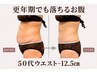 【セル脂肪撃退★上半身】二の腕・背中・お腹を夏までに理想へサイズダウン