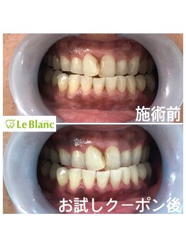 ルブラン 奈良店(Le Blanc)/ご家族でwhitening!!