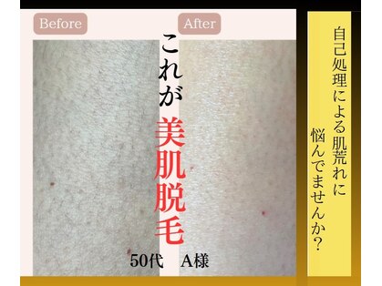 リードエピア(LEADepiA)の写真