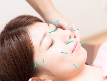 ソライロ鍼灸接骨院/美容鍼