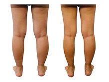 ベンザイ 新潟店(BENZAI)/伝わらないけど実感高い写真