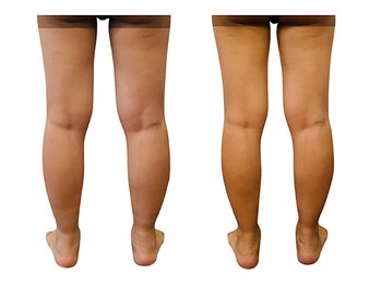 ベンザイ 新潟店(BENZAI)/伝わらないけど実感高い写真