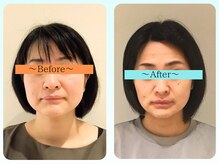 シンメトリー たまプラーザテラス店の雰囲気（左右差/目の大きさ/ほうれい線/むくみ/肌荒れ/肌のくすみ）