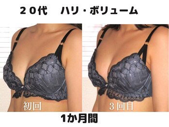 バストサロン メルベイユ(Merveile)/デコルテからボリュームアップ