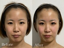 ベルシー(BELTHY)の雰囲気(小顔矯正90分¥13,000)