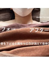 カオン(Kaon)/肩もっこりが消える