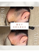 ビーエックス(.BX)/全身脱毛・うなじ脱毛・ワックス