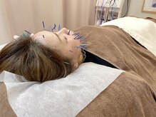 こじま 富雄団地接骨院/美容鍼