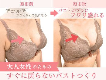 ベルフルール/バストアップ/熊本/南熊本