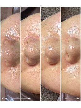 サロン フェリシア(salon Felicia)/40代女性Before/After