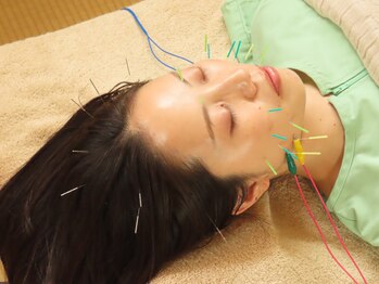 NAOホリスティック鍼灸サロンの写真/【気になる肌悩みに◎】毛穴の開きやニキビにお悩みの方に。クマ/たるみケア/シワケアも同時に叶えます◎