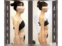 ソウ バイ ソウ(So by 蒼)/匠のオ－ダ－。本物の骨格矯正