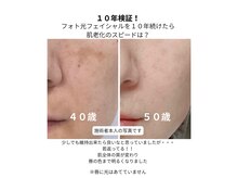 トータルビューティーサロン ハルキ(TOTAL BEAUTY SALON HARUKI)の雰囲気（肌老化にはフォト導入でハリ透明感！老いのスピードをスローに◎）
